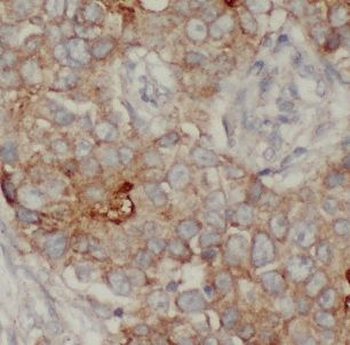 IL13RA2 Antibody