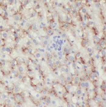 IL15RA Antibody