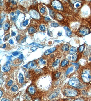 IL17A Antibody