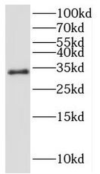 IL17F Antibody