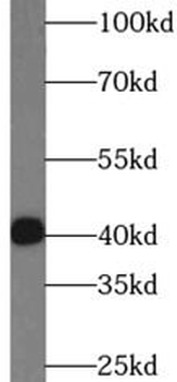 IL17F Antibody