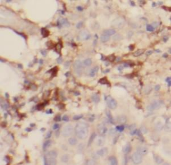 IL17RB Antibody