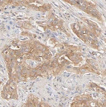 IL17RE Antibody