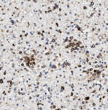 IL36A Rabbit Polyclonal Antibody