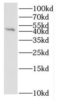 IL36B Rabbit Polyclonal Antibody