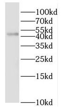 IL1R2 Rabbit Polyclonal Antibody