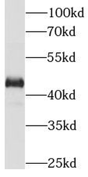 IL1R2 Mouse Monoclonal Antibody