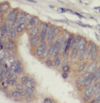 IL1RN Antibody