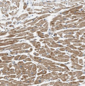 IL1RAPL1 Antibody