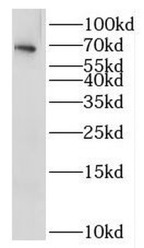IL1RL2 Antibody
