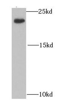 IL21 Antibody