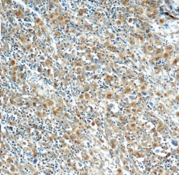 IL21R Antibody