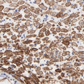 IL27 Antibody