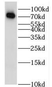 IL2RB Rabbit Polyclonal Antibody