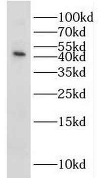 IL2RG Rabbit Polyclonal Antibody