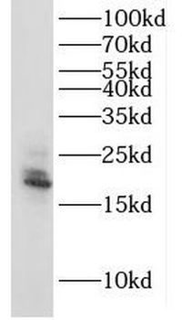 IL3 Rabbit Polyclonal Antibody