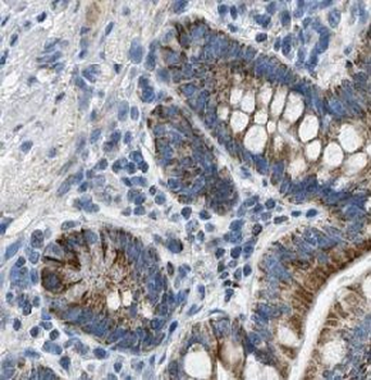 IL31 Antibody
