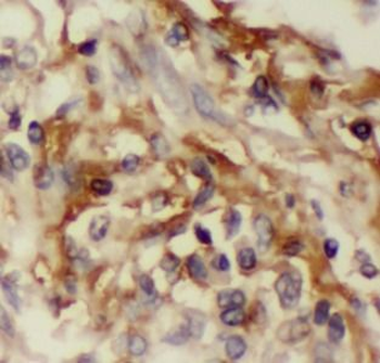 IL32 Antibody
