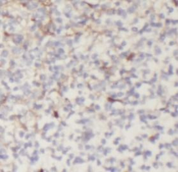 IL33 Antibody