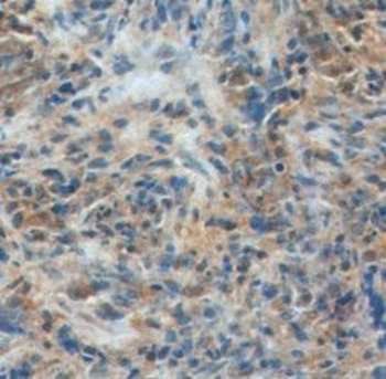 IL33 Antibody
