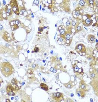 IL4 Rabbit Polyclonal Antibody