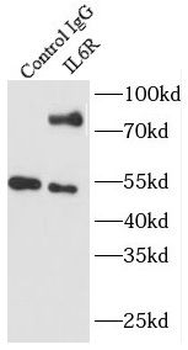 IL6R Antibody