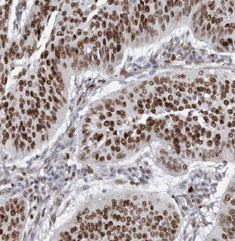 ILF3 Antibody