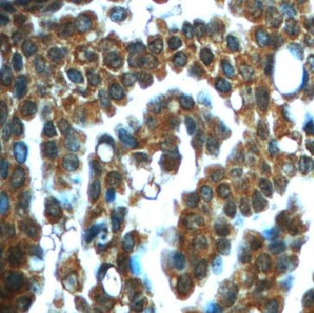 IMPDH1 Antibody