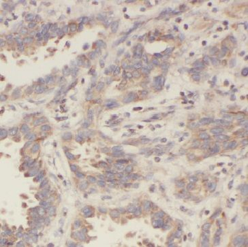 IMPDH2 Antibody