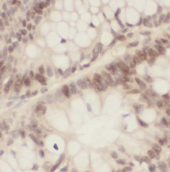 ING2 Antibody