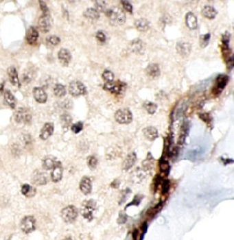 ING4 Antibody