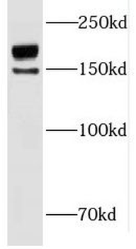 INO80 Rabbit Polyclonal Antibody