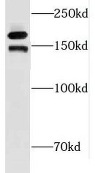 INO80 Rabbit Polyclonal Antibody