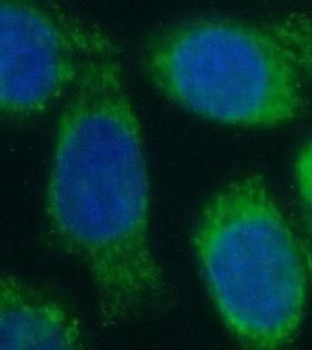 NOS2 Antibody