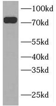 INPP5B Rabbit Polyclonal Antibody