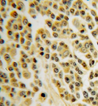 INPP5B Rabbit Polyclonal Antibody