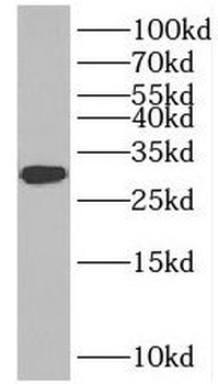 INSIG2 Antibody