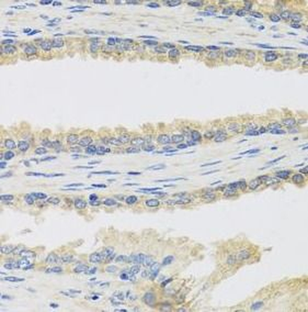 INSL3 Antibody