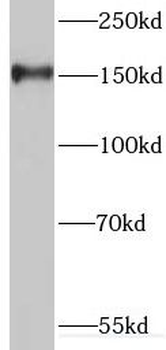 INSRR Rabbit Polyclonal Antibody