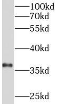 INS Rabbit Polyclonal Antibody