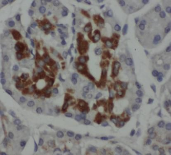 INS Rabbit Polyclonal Antibody