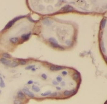 ITGB1 Rabbit Polyclonal Antibody