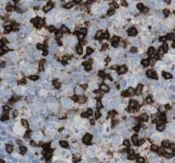 ITGB7 Antibody