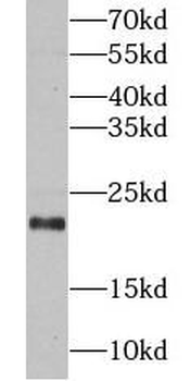 IFNA1 Mouse Monoclonal Antibody