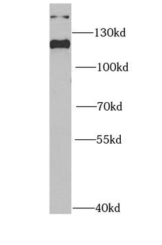 INTS5 Rabbit Polyclonal Antibody