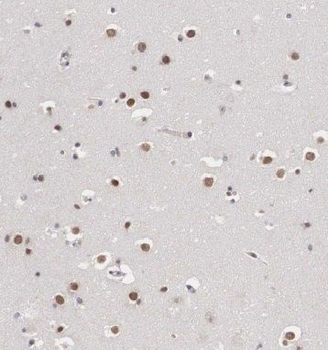 INTS7 Antibody
