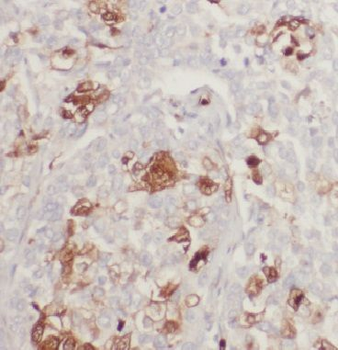 IP6K1 Antibody