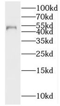 IP6K2 Rabbit Polyclonal Antibody