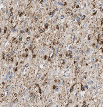 IPPK Antibody