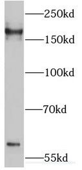 IQGAP2 Rabbit Polyclonal Antibody